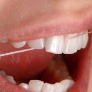 Zahnseide zur täglichen Zahnpflege