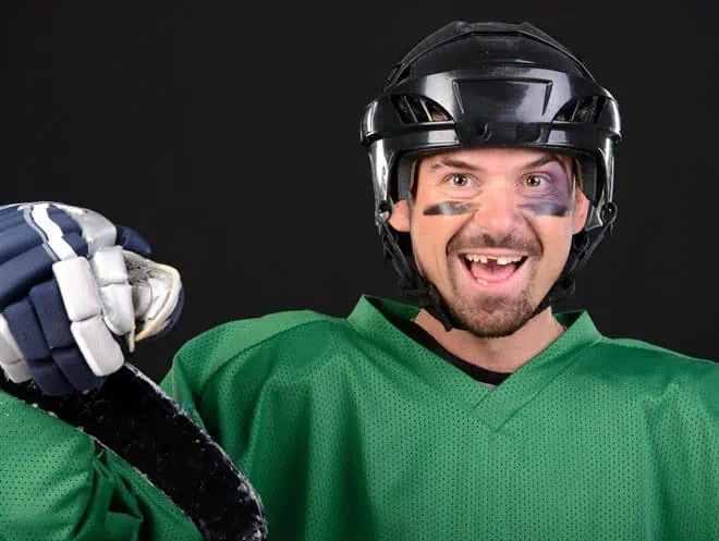 Sportschutzschienen retten Zähne bei topDentis Cologne
