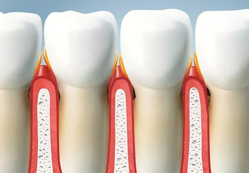 Topdentis Cologne Zahnarzt Koeln Zahnreihe Ohne Parodontitis