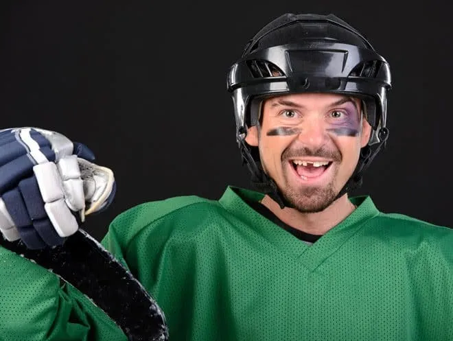 Sportschutzschienen retten Zähne bei topDentis Cologne